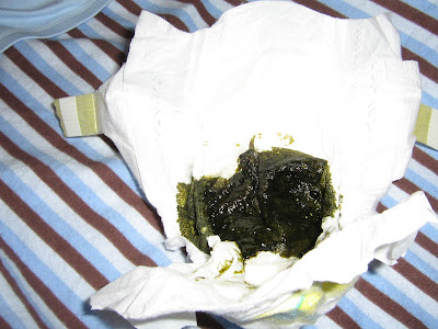 Meconium.JPG